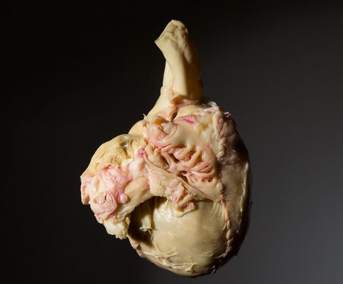 Image Design: Human Hearts, Crystals and Leeks